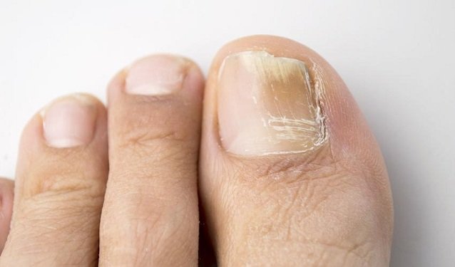 toenail.jpg